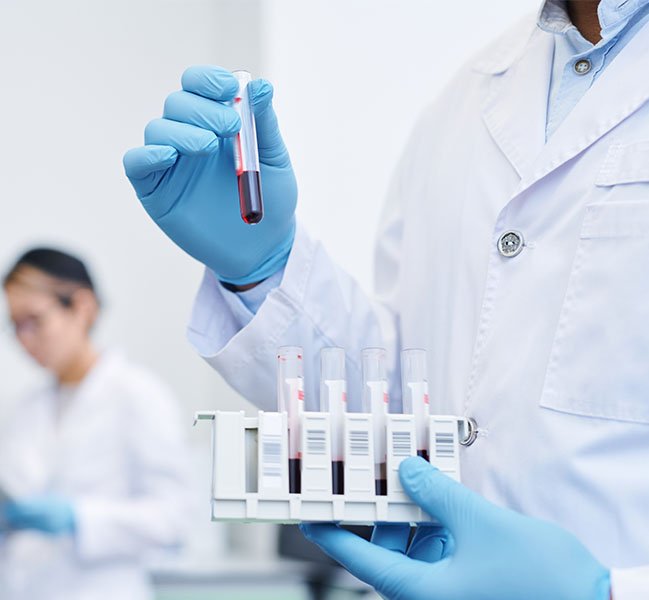 Exames de Sangue